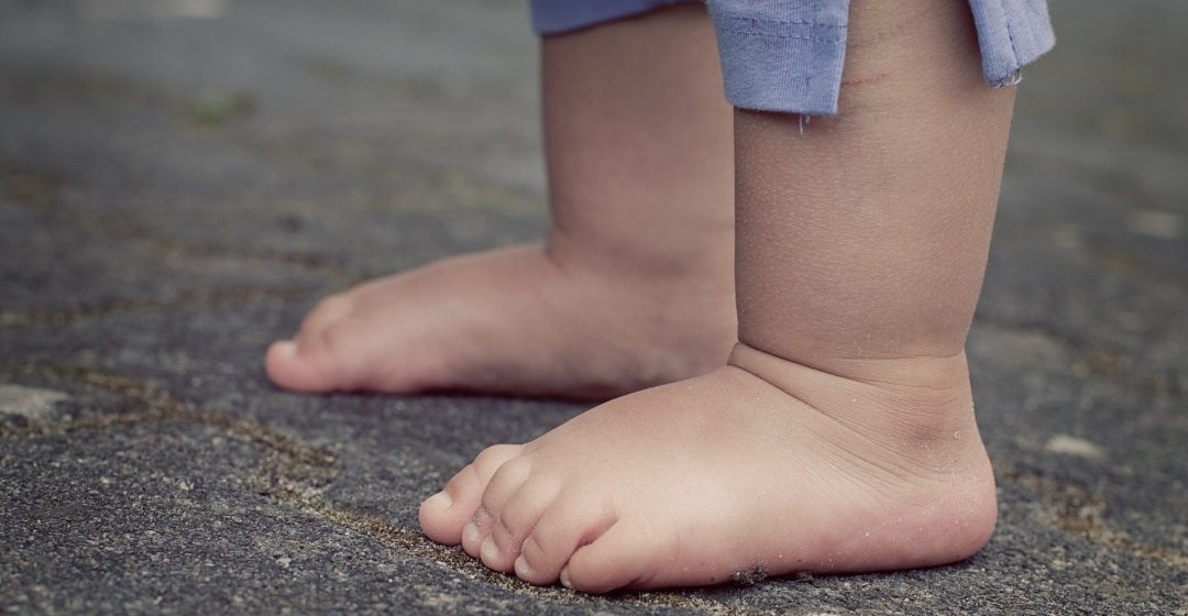 Trójpłaszczyznowa manualna terapia wad stóp u dzieci